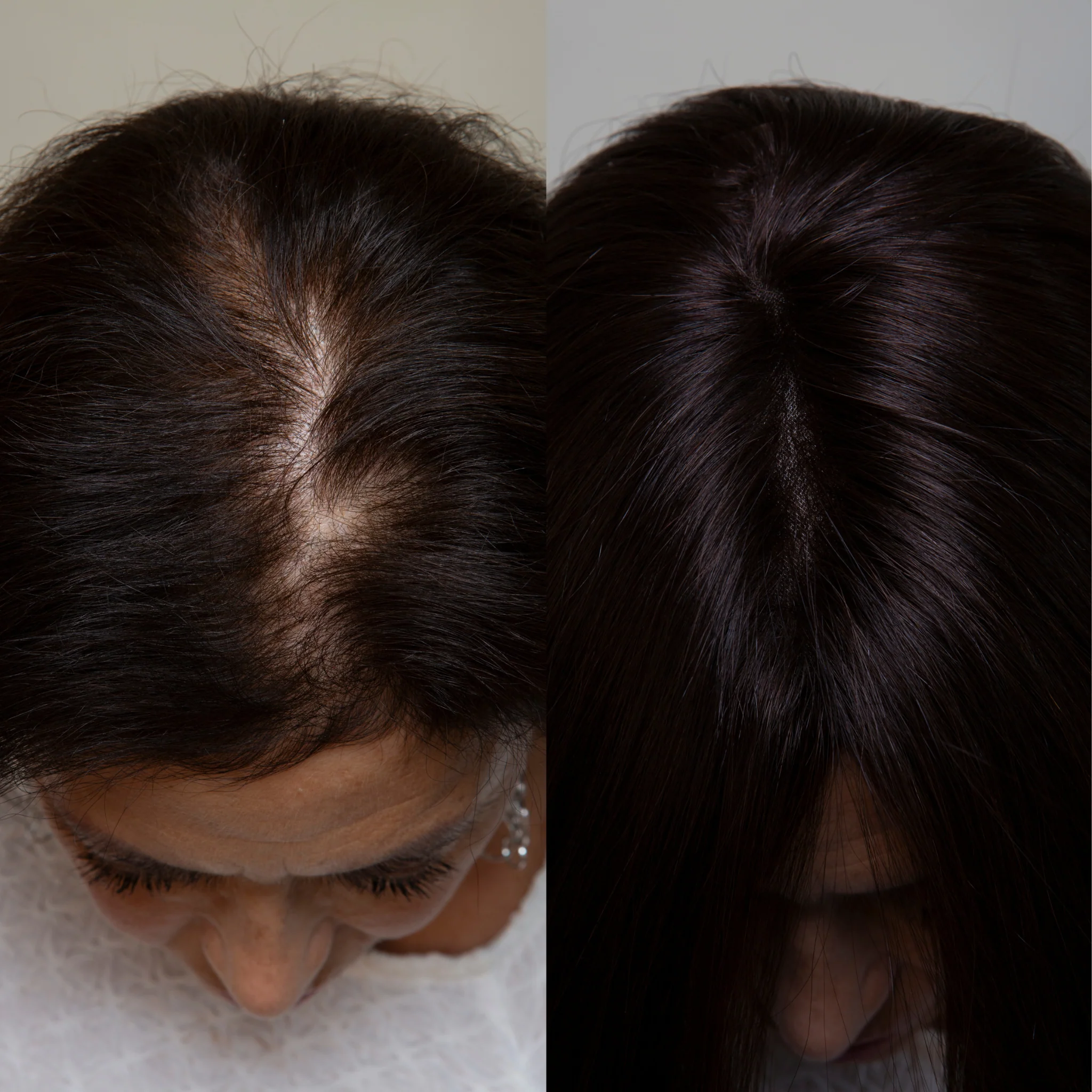 Clio 12 S PLUS | Remy Human Hair Topper (Reinforced Hand-Tied Base) - Image 4