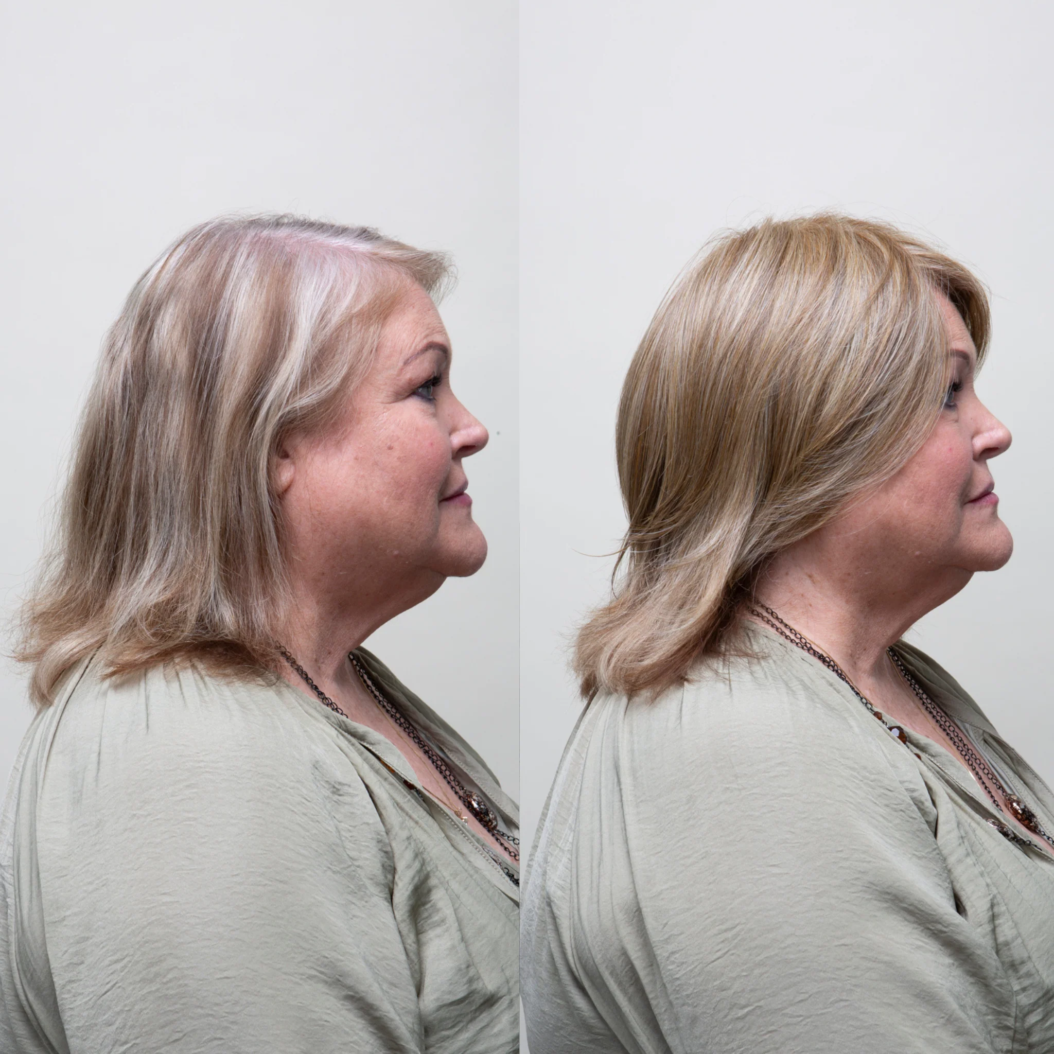 Clio 8 L | Hand-Tied Synthetic Hair Topper (Heat-Friendly) - Image 4